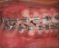 Dentist in ahmednagar